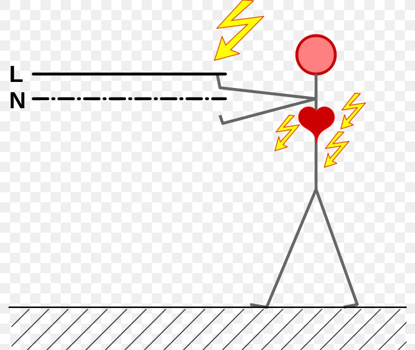 Electrical Injury Electric Current Diagram Clip Art, PNG, 788x692px, Electrical Injury, Accident, Ampere, Area, Diagram Download Free