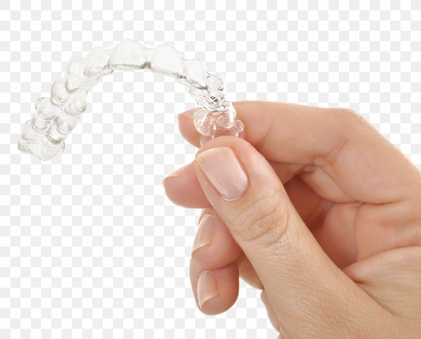 Clear Aligners Dental Braces Orthodontics Dentistry, PNG, 1157x932px, Clear Aligners, Bracelet, Bridge, Crown, Dental Braces Download Free