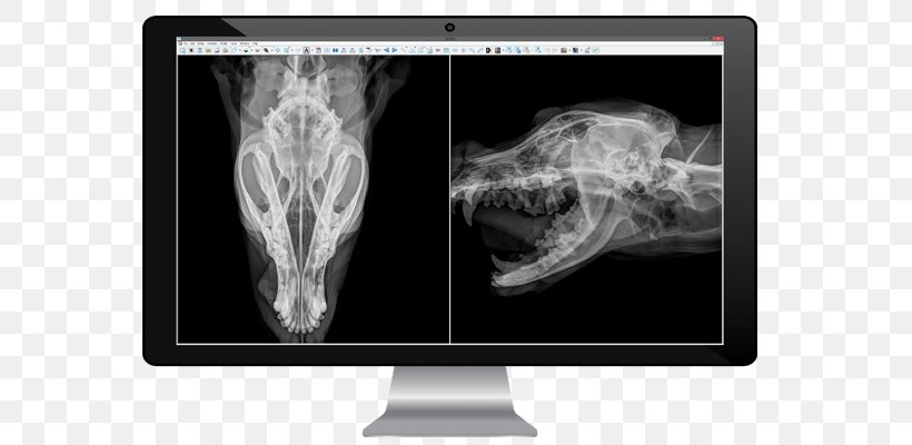 Medical Imaging Radiology Medicine X-ray Radiography, PNG, 650x400px, Medical Imaging, Black And White, Bone, Brand, Computed Tomography Download Free