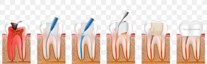 Dentistry Endodontic Therapy Endodontics, PNG, 2560x800px, Dentistry, Dentist, Disease, Endodontic Therapy, Endodontics Download Free