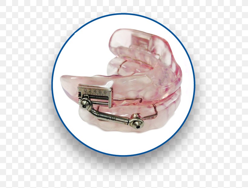 Mandibular Advancement Splint Obstructive Sleep Apnea Dentistry, PNG, 600x623px, Mandibular Advancement Splint, Continuous Positive Airway Pressure, Dentist, Dentistry, Dr Sharnell Muir Download Free