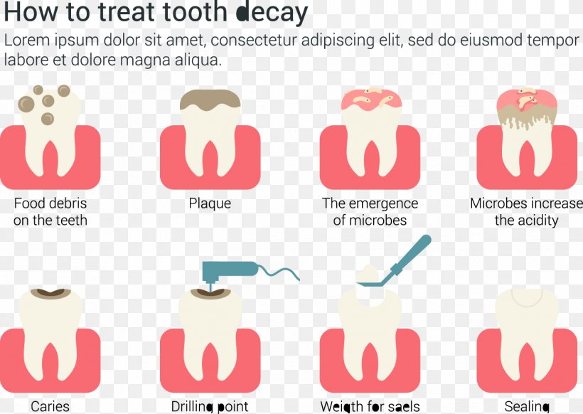 Tooth Decay Dentistry Euclidean Vector, PNG, 1345x955px, Watercolor, Cartoon, Flower, Frame, Heart Download Free