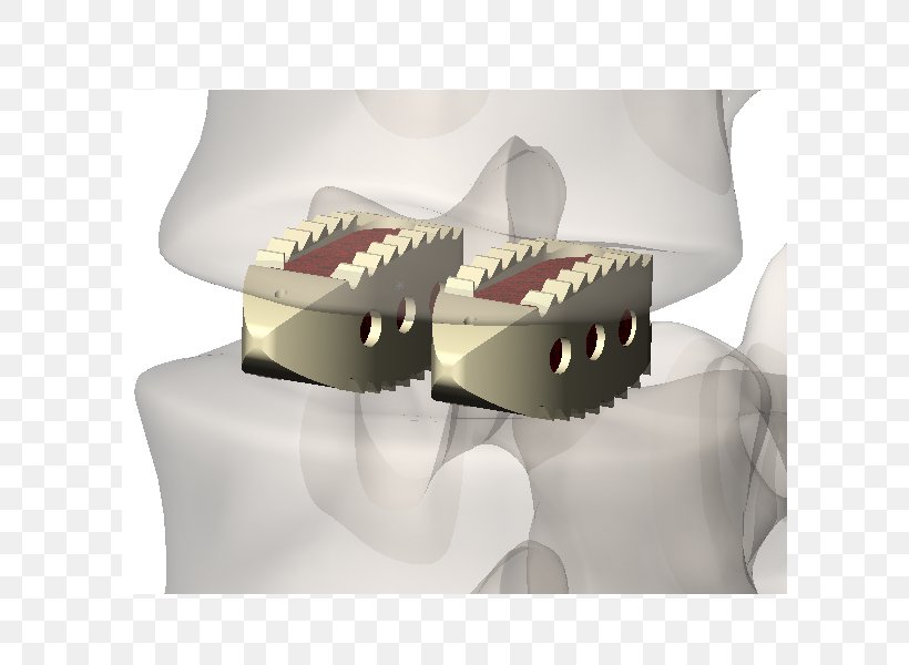 Jaw, PNG, 600x600px, Jaw, Box Download Free