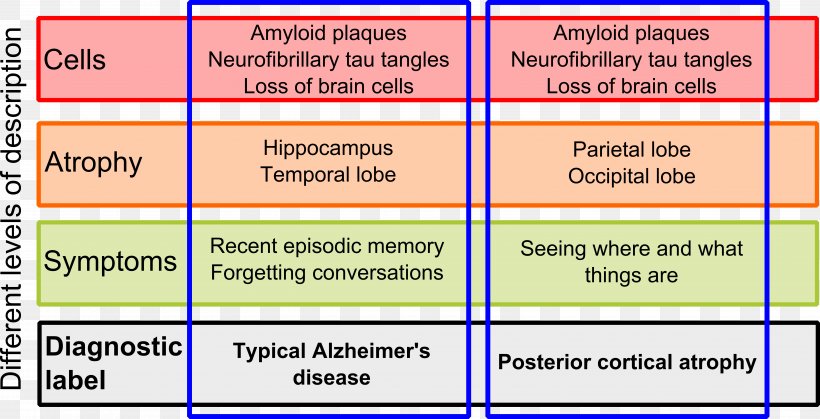 Cerebral Atrophy Brain Dementia Symptom, PNG, 6415x3278px, Cerebral Atrophy, Area, Atrophy, Brain, Dementia Download Free