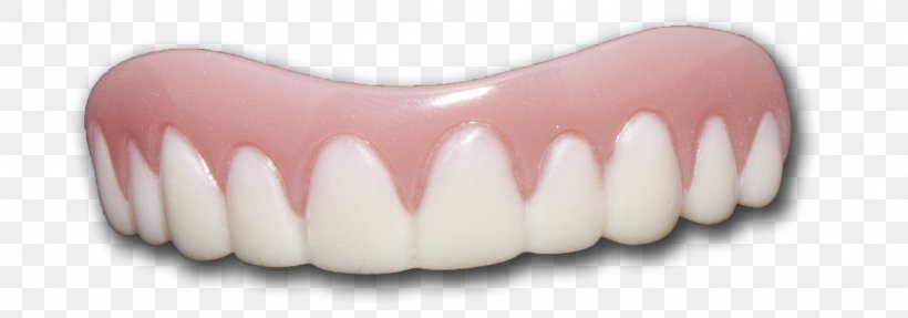 Human Tooth Veneer Dentures, PNG, 2040x716px, Watercolor, Cartoon, Flower, Frame, Heart Download Free