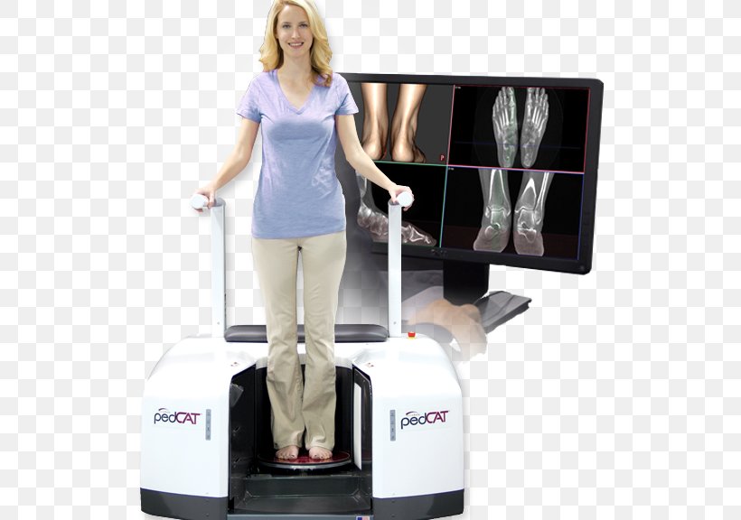 Cone Beam Computed Tomography Weight-bearing Podiatrist X-ray, PNG, 516x576px, Cone Beam Computed Tomography, Ankle, Computed Tomography, Foot, Foot And Ankle Surgery Download Free