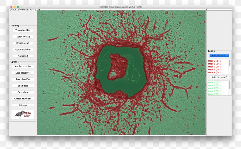ImageJ Image Segmentation Image Analysis, PNG, 2972x1844px, Imagej, Angiogenesis, Aorta, Assay, Brand Download Free