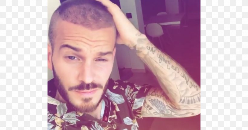 M. Pokora Hair Transplantation Eyebrow Hair Coloring Hairstyle, PNG, 1200x630px, M Pokora, Beauty, Capelli, Capillary, Chin Download Free