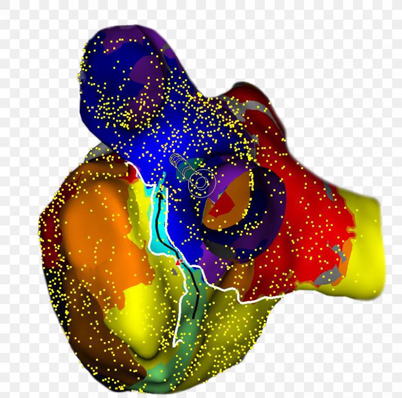 UNC Health Care Cardiology Medicine Heart Accuracy And Precision, PNG, 841x833px, Unc Health Care, Abbott Laboratories, Accuracy And Precision, Atrial Fibrillation, Atrial Flutter Download Free