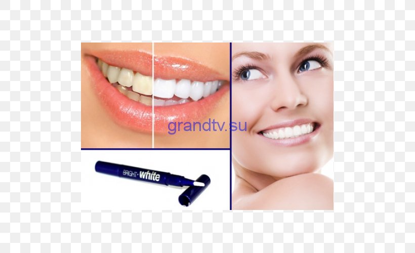 Tooth Whitening Dentistry Dental Surgery Health, PNG, 500x500px, Tooth Whitening, Cheek, Chin, Clinic, Cosmetic Dentistry Download Free