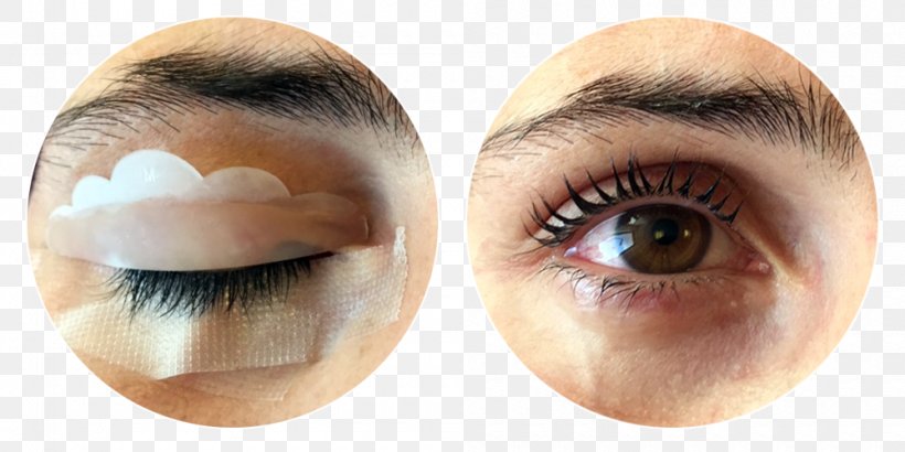 Eyelash Extensions Hair Transplantation Eye Shadow Eye Liner, PNG, 1000x500px, Eyelash Extensions, Artificial Hair Integrations, Beauty, Blepharoplasty, Close Up Download Free