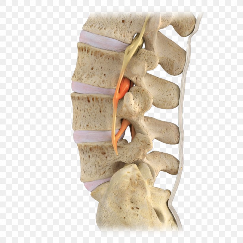 Lumbar Vertebrae Vertebral Column Spinal Stenosis Spinal Nerve, PNG, 1024x1024px, Lumbar Vertebrae, Cervical Vertebrae, Human Back, Joint, Lumbar Download Free