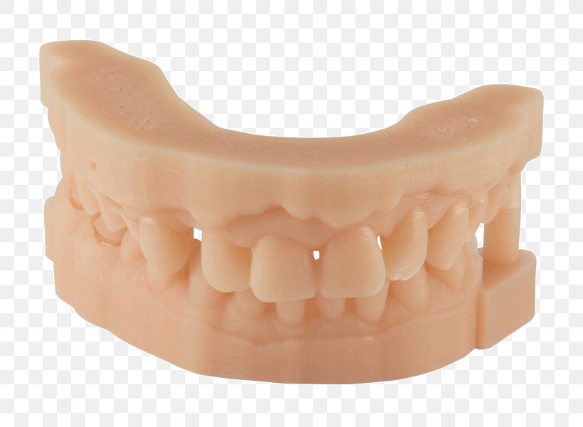 3D Printing Resin Dentistry Tooth, PNG, 800x600px, 3d Printing, Acrylonitrile Butadiene Styrene, Dental Composite, Dentistry, Dentures Download Free