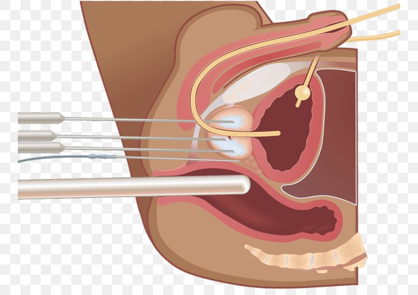 Acoustic Guitar Thumb, PNG, 750x580px, Watercolor, Cartoon, Flower, Frame, Heart Download Free