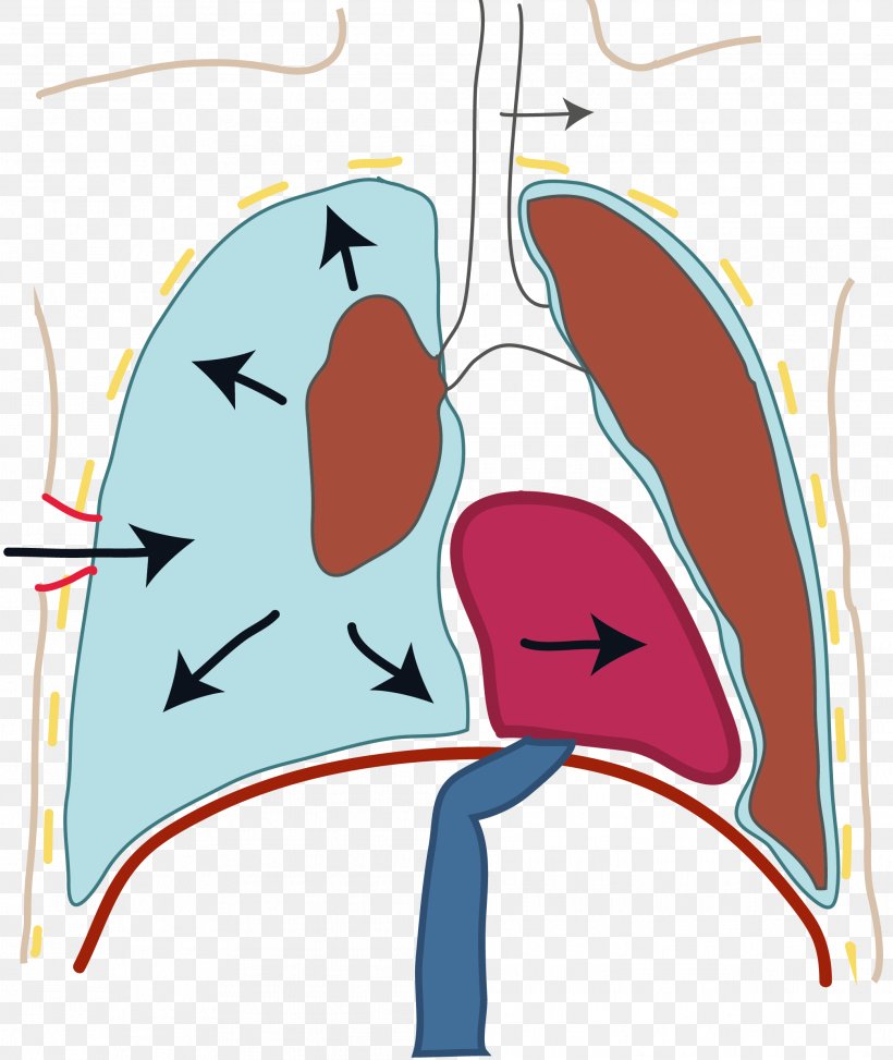 Cyanosis Heart Ailment Cardiology Orthopnea Clip Art, PNG, 2088x2480px, Watercolor, Cartoon, Flower, Frame, Heart Download Free