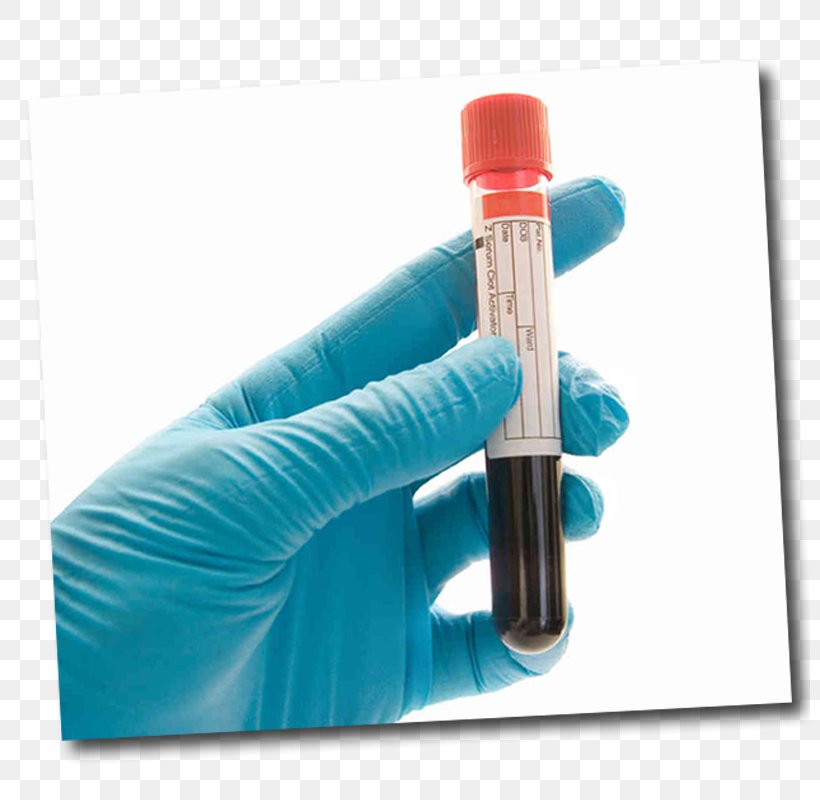 Blood Test Drug Test Herpes Simplex Hepatitis B, PNG, 800x800px, Blood Test, Alcohol, Blood, Blood Alcohol Content, Blood Donation Download Free