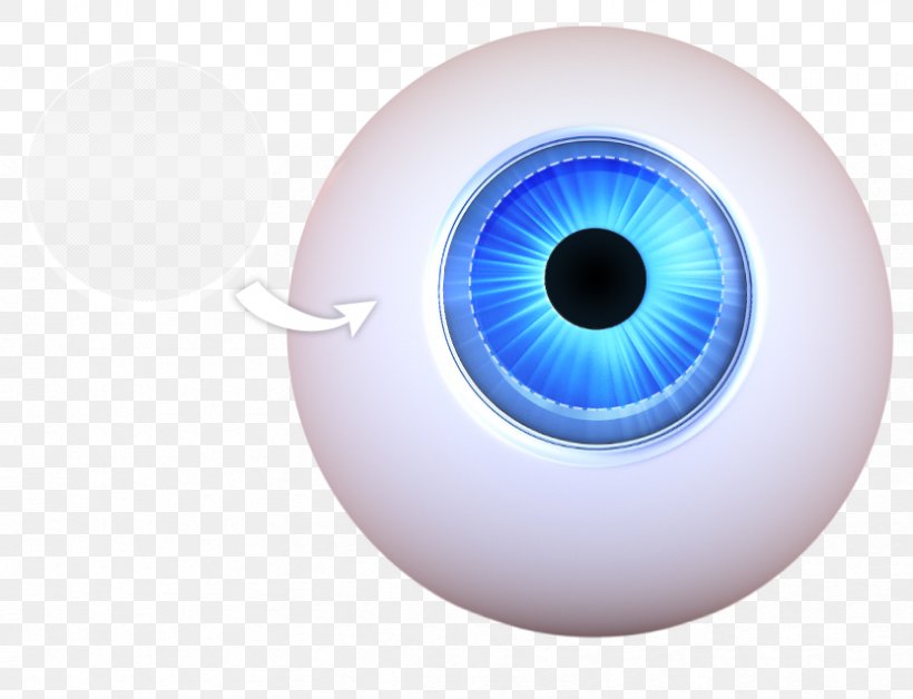Keratoprosthesis Corneal Transplantation Iris Eye, PNG, 832x638px, Watercolor, Cartoon, Flower, Frame, Heart Download Free