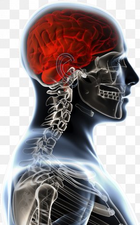 Head Injury - Brain Tumor Anatomy Anatomia Y Fisiologia Physiology PNG
