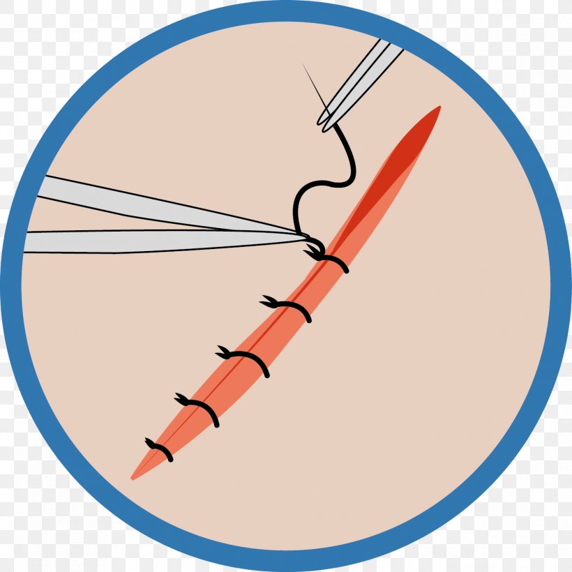 Wound Medicine Blood Gynaecology Anesthesia, PNG, 1344x1344px, Wound, Anesthesia, Area, Blood, Family Medicine Download Free