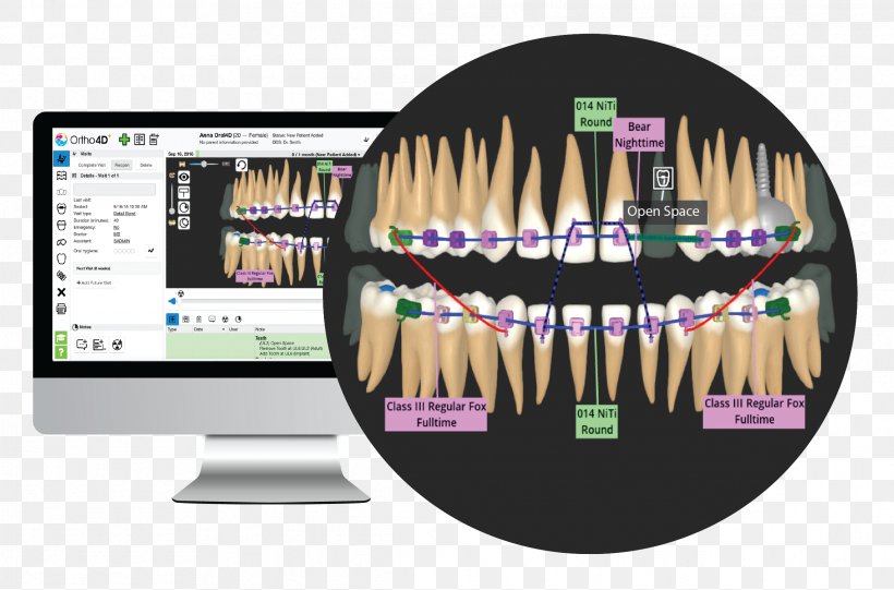 Orthodontics Human Tooth Clear Aligners Dentistry, PNG, 2333x1542px, Orthodontics, Advertising, Brand, Clear Aligners, Dentistry Download Free