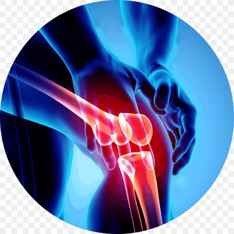 Knee Pain Shoulder, PNG, 1000x1000px, Knee Pain, Arthritis, Bone, Electric Blue, Human Anatomy Download Free