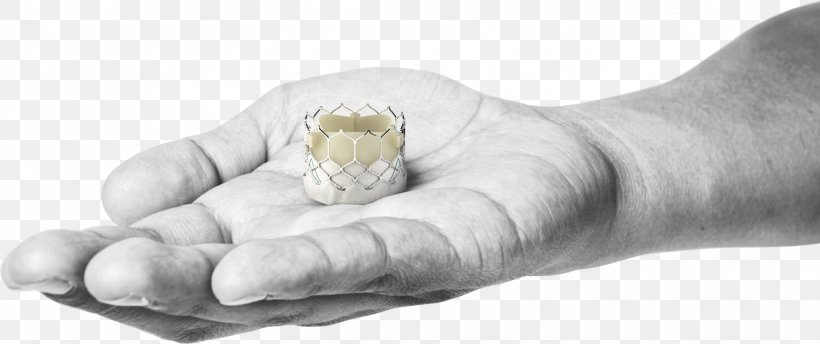 Percutaneous Aortic Valve Replacement Edwards Lifesciences Heart Valve Aortic Stenosis, PNG, 1532x643px, Edwards Lifesciences, Aorta, Aortic Stenosis, Aortic Valve, Aortic Valve Replacement Download Free