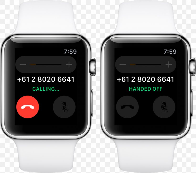 Apple Watch Series 2 Apple Watch Series 3 Apple Watch Series 1, PNG, 986x872px, Apple Watch Series 2, Apple, Apple Music, Apple Watch, Apple Watch Series 1 Download Free
