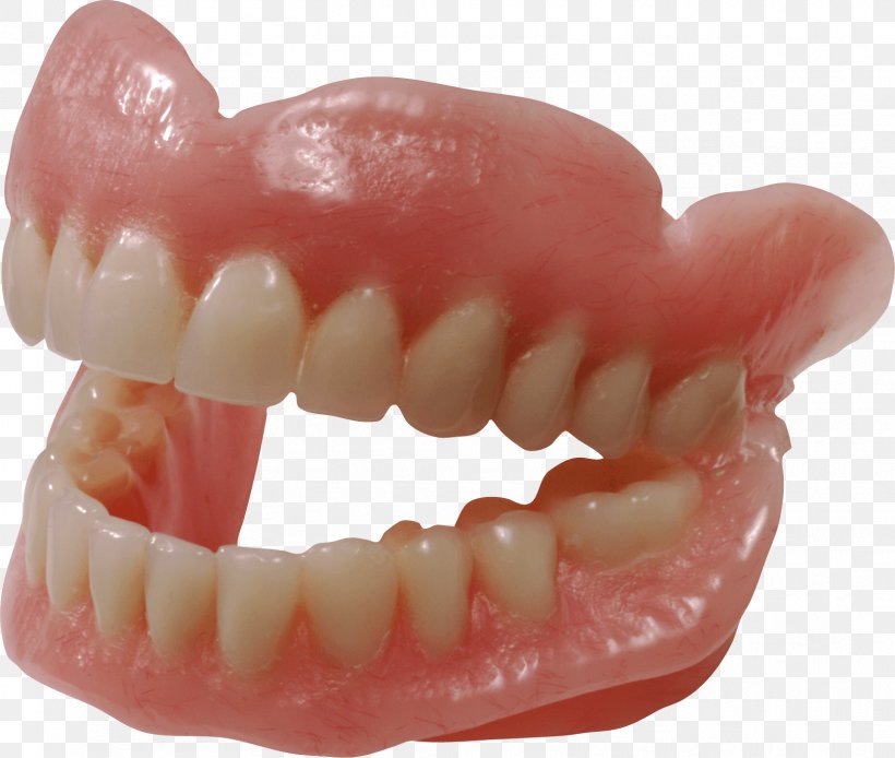 Human Tooth Dentures, PNG, 1662x1408px, Human Tooth, Dentist, Dentistry, Dentures, Gums Download Free