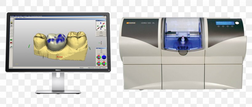 CAD/CAM Dentistry Crown Dental Restoration Inlays And Onlays, PNG, 3101x1326px, Cadcam Dentistry, Bridge, Communication, Computer Monitor Accessory, Crown Download Free