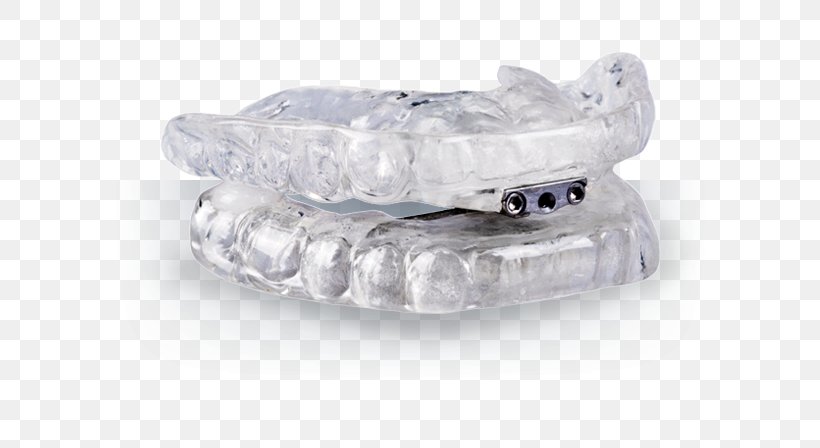 Mouthguard Mandibular Advancement Splint Dentistry Sleep Apnea, PNG, 600x448px, Mouthguard, Apnea, Body Jewelry, Crystal, Dental Implant Download Free