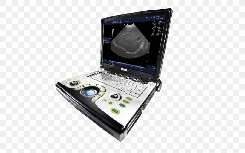 Portable Ultrasound GE Healthcare Voluson 730 Medical Imaging, PNG, 960x600px, Ultrasound, Cardiology, Electronics, Ge Healthcare, General Electric Download Free