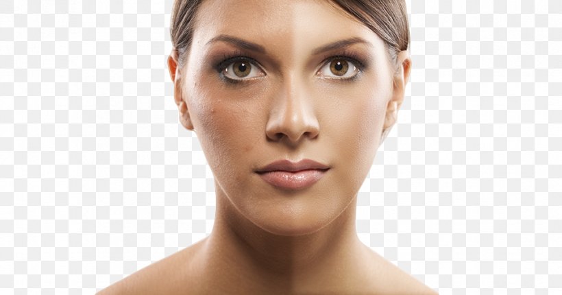 Photography Skin Image Cosmetics Face, PNG, 953x500px, Photography, Beauty, Brown Hair, Cheek, Chin Download Free