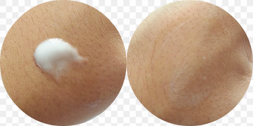 Lotion Cream Niacin Nicotinamide Moisturizer, PNG, 1600x800px, Lotion, Acne, Cream, Egg, Face Download Free