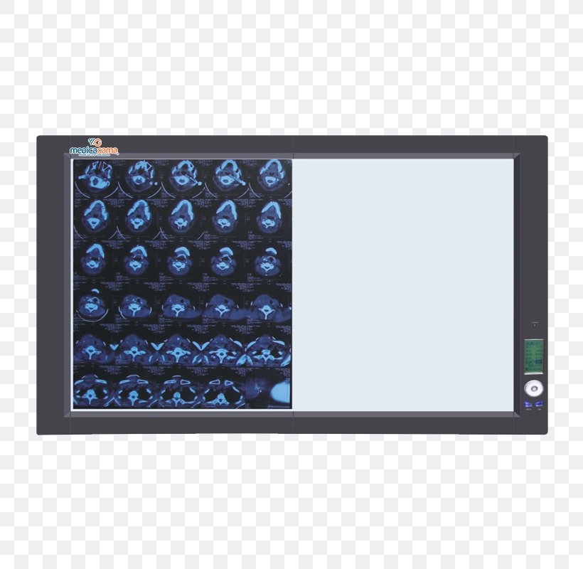 Veterinary Medicine Medical Laboratory X-ray Ultrasonography, PNG, 800x800px, Medicine, Display Device, Electronics, Laboratory, Lead Apron Download Free