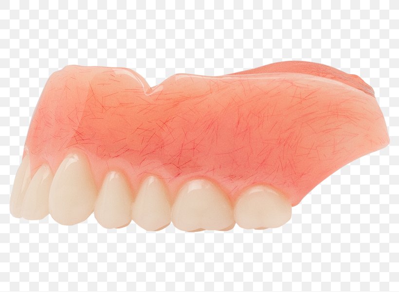 Human Tooth Dentures, PNG, 800x601px, Tooth, Dentures, Finger, Human Tooth, Jaw Download Free