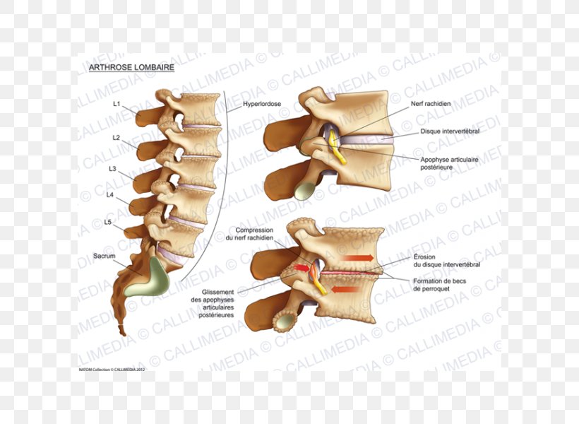 Joint Cervical Osteoarthritis Lumbar Vertebrae Process, PNG, 600x600px, Joint, Anatomy, Cancer, Human Anatomy, Human Back Download Free