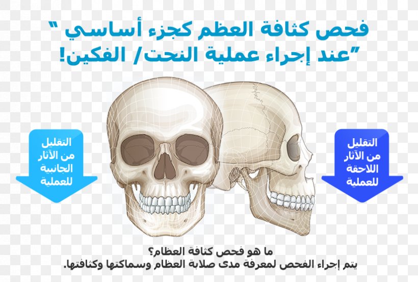 Plastic Surgery Nose Orthognathic Surgery Hospital, PNG, 825x557px, Plastic Surgery, Bone, Clinic, Ear, Face Download Free