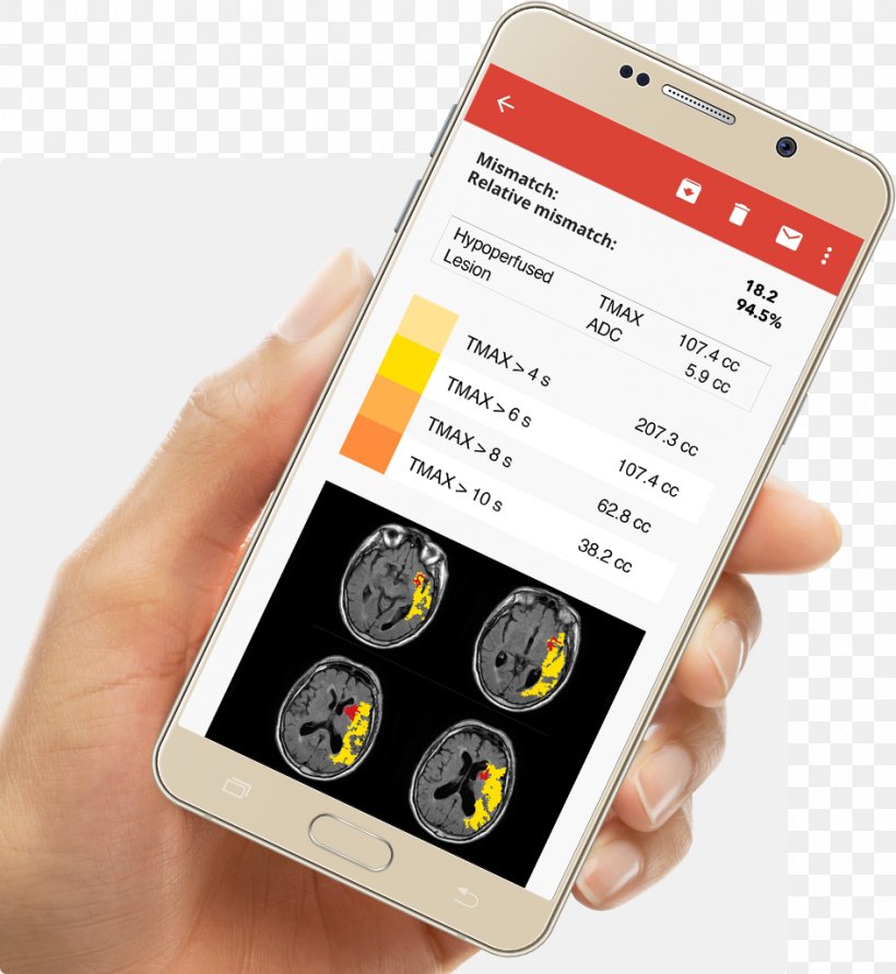 Smartphone La Ciotat Olea Medical Perfusion MRI Mobile Phones, PNG, 946x1029px, Smartphone, Cabinetry, Cellular Network, Communication Device, Computed Tomography Download Free