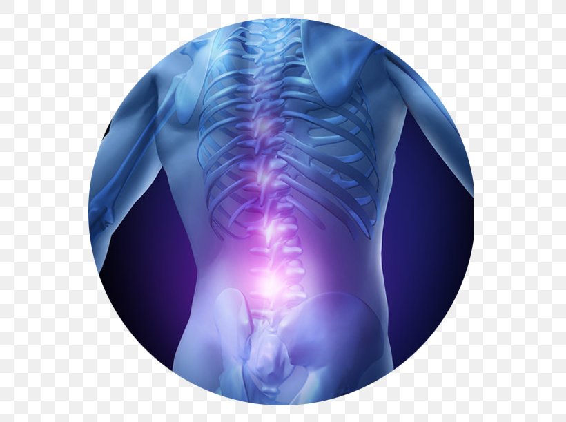 Low Back Pain Pain Management Therapy Spinal Disc Herniation, PNG, 586x611px, Back Pain, Human Back, Intervertebral Disc, Jaw, Joint Download Free