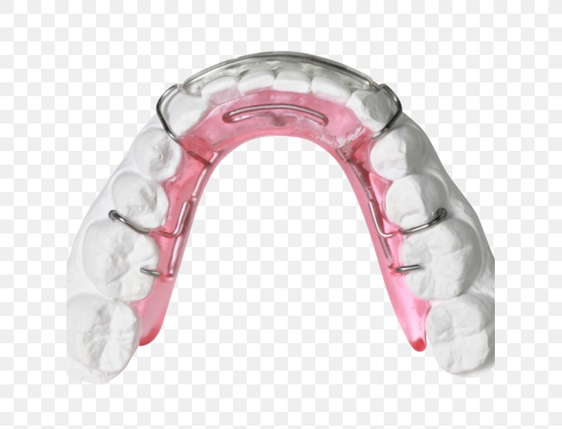 Clear Aligners Orthodontics Orthodontic Technology Jaw Bionator, PNG, 625x625px, Clear Aligners, Bionator, David Gergen, Dentistry, Jaw Download Free