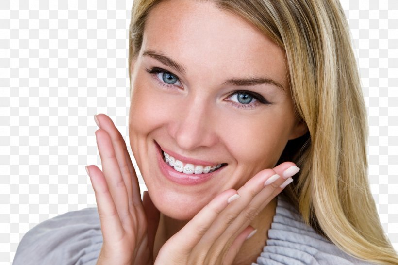 Dental Braces Dentistry Orthodontics Clear Aligners, PNG, 1500x1000px, Dental Braces, Albert Klitzke Dds, All Smiles Dental, Beauty, Blond Download Free