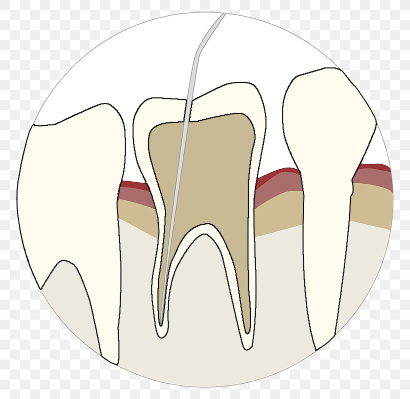 Tooth Velopex International Dentistry Air-Polishing Endodontics, PNG, 798x799px, Watercolor, Cartoon, Flower, Frame, Heart Download Free