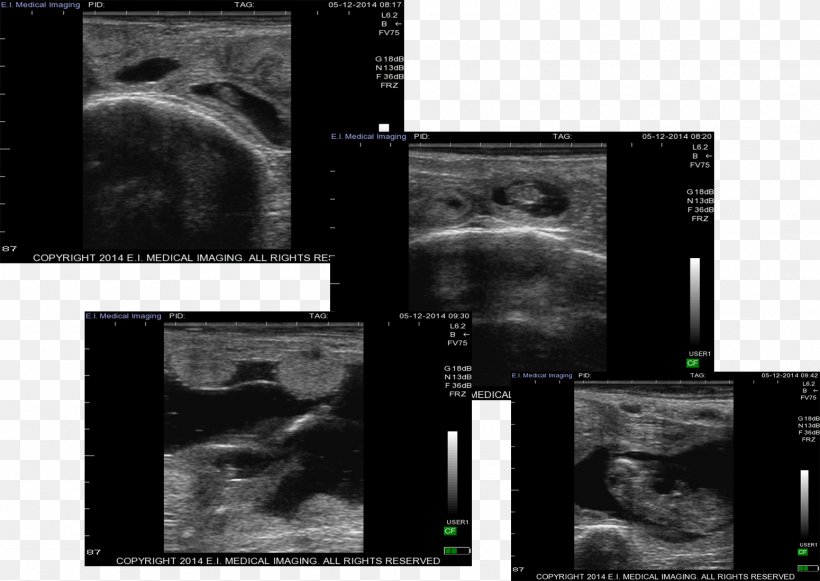 Medical Imaging Radiology Desktop Wallpaper Screenshot Medicine, PNG, 1550x1099px, Medical Imaging, Black And White, Computer, Editing, Magnetic Resonance Imaging Download Free