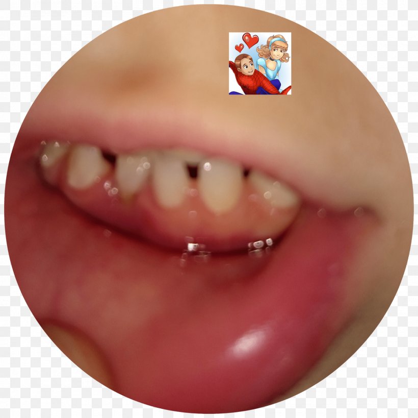 Chin Cheek Mouth Jaw Lip, PNG, 1600x1600px, Chin, Cheek, Close Up, Closeup, Jaw Download Free