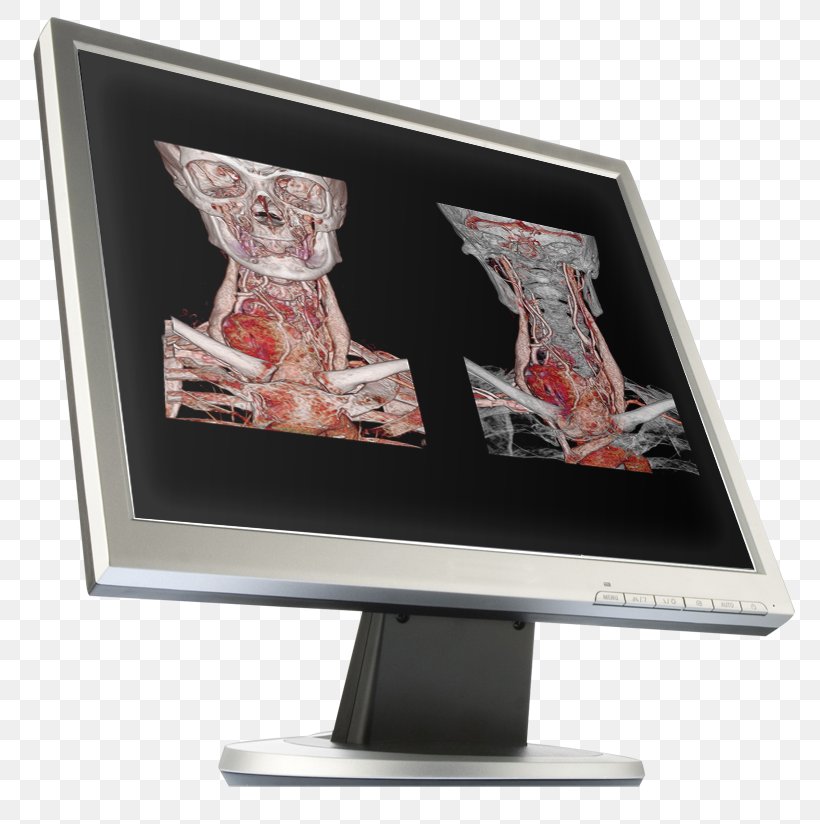 Computer Monitors Workflow Image Computed Tomography Canon Medical Systems Corporation, PNG, 809x824px, Computer Monitors, Canon, Canon Medical Systems Corporation, Computed Tomography, Computer Monitor Download Free