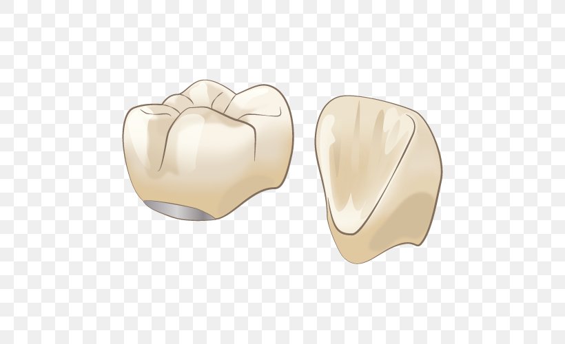 審美歯科 Dentist Therapy Crown, PNG, 500x500px, Dentist, Crown, Dental Implant, Dentistry, Earrings Download Free