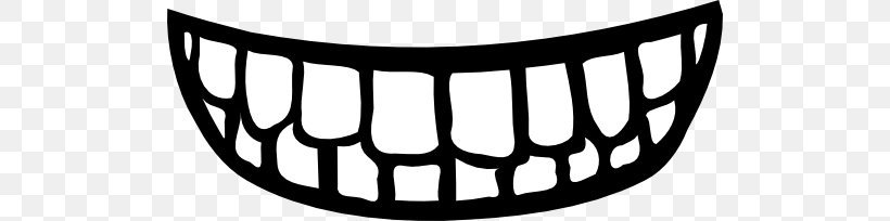 Human Tooth Smile Mouth Clip Art, PNG, 512x204px, Human Tooth, Auto Part, Black, Black And White, Dental Braces Download Free