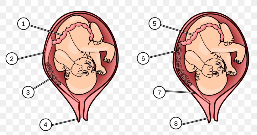 Placenta Praevia Human Fetus Uterus, PNG, 1600x841px, Watercolor, Cartoon, Flower, Frame, Heart Download Free