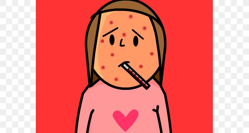 Chickenpox Itchy, Itchy Chicken Pox Varicella Zoster Virus Clip Art, PNG, 583x438px, Watercolor, Cartoon, Flower, Frame, Heart Download Free