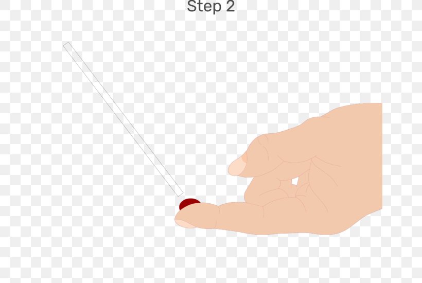Blood Drawing Clotting Time Hematocrit, PNG, 666x550px, Blood, Animation, Arm, Capillary, Cartoon Download Free